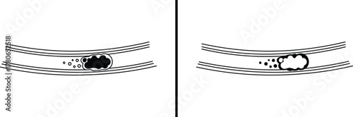 Embolism in Blood Vessel Icon – Artery Blockage and Clot Illustration