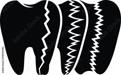 Dental Decay Illustration Showing Tooth Decay and Damage Indicating Poor Oral Health and Hygiene Concerns
