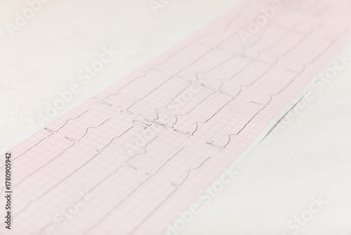 Wallpaper Mural Medical stethoscope, red heart, and cardiogram on a color background. ECG, Heart wave, heart attack, cardiogram report. Cardiogram pulse trace and heart concept. Healthcare.Space for text Torontodigital.ca