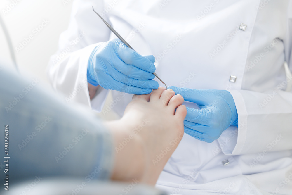 Fototapeta premium Care pedicure, process Podiatrist treating patient foot woman with precision, white background