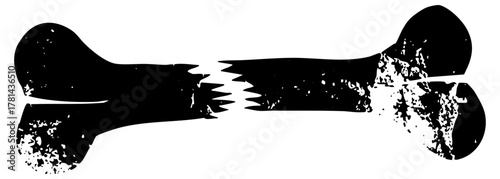 Broken bone illustrates fracture in medical context