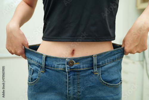 Asian woman with cellulite on leg skin fat, overweight problem.