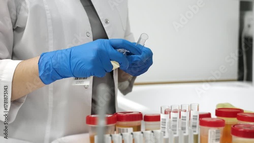Lab technician in blue gloves labeling urine sample test tube with barcode in modern medical laboratory for diagnostic analysis and research.