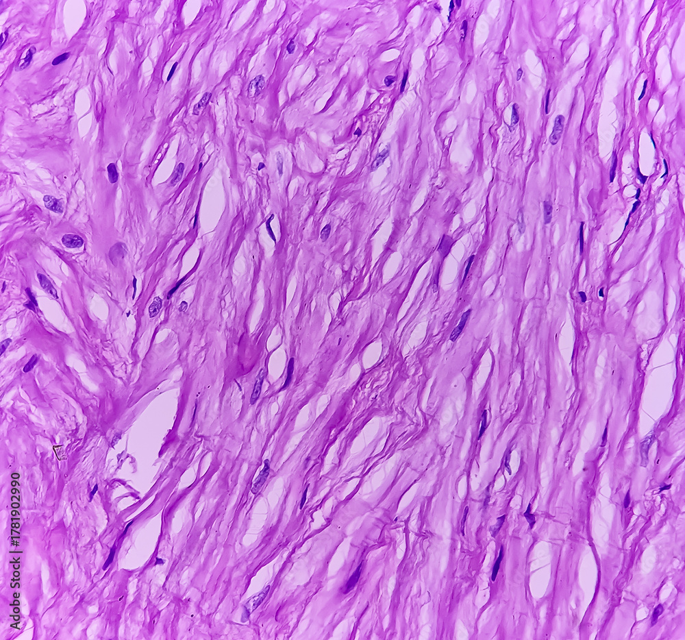 Fototapeta premium Microscopic image of seminiferous tubules showing atrophic changes, Sartoli cell are hyperplastic.