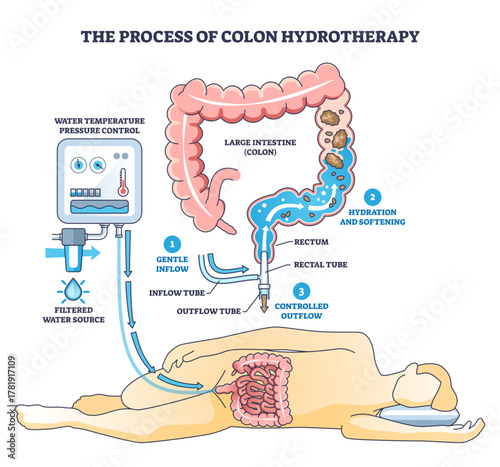 Colon hydrotherapy process diagram shows gentle inflow, hydration, and controlled outflow, key objects, colon, rectal tube, water control unit, transparent background.