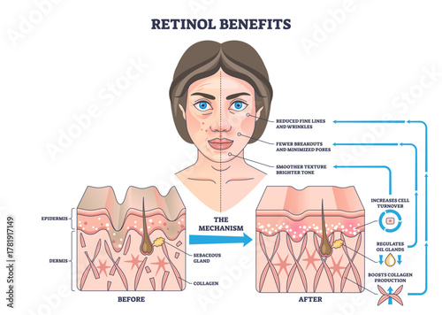 Retinol benefits outline showing how retinol boosts collagen and cell turnover, woman s face, skin cross-sections before-after, and arrows explain clearer texture and fewer wrinkles.