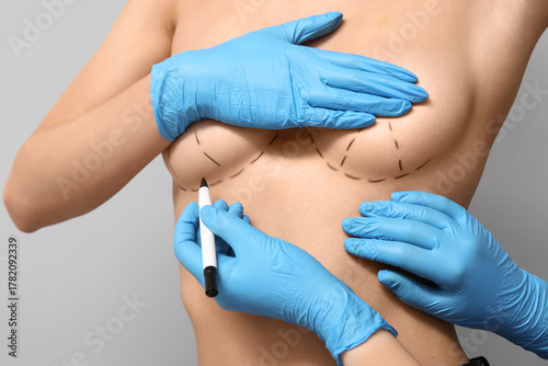 Doctor drawing marks on fem...