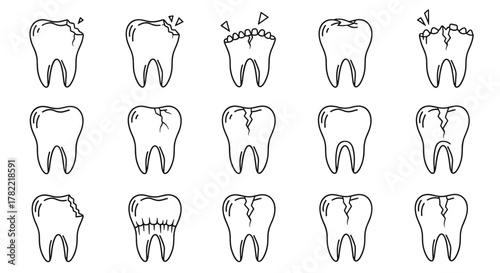Collection of 15 hand-drawn outline illustrations of broken teeth, showcasing various types of damage like chips, cracks, and decay, presented on a clean white background for versatile graphic and