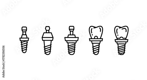 Set of five minimalistic line art icons representing dental implants and a tooth crown on an implant, isolated on a white background. This vector graphic collection is ideal for concepts, apps, and