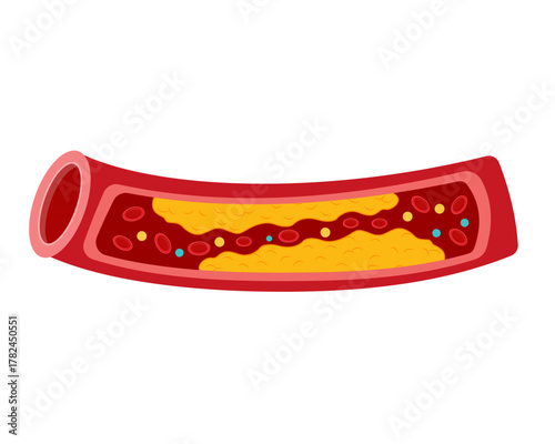 cholesterol in human blood vessels vector illustration