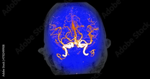 Magnetic resonance angiography of the brain shows detailed cerebral arteries. Advanced imaging technology supports precise radiology diagnosis. Useful for medical education and research.