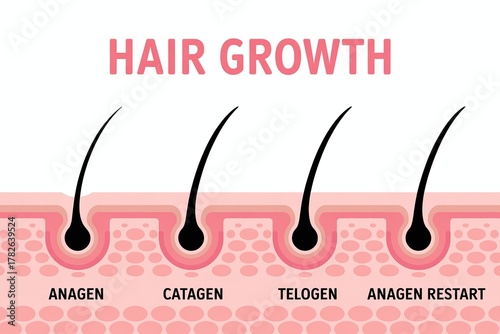 Medical Illustration Showing Hair Growth Cycle with Anagen, Catagen, and Telogen Stages

