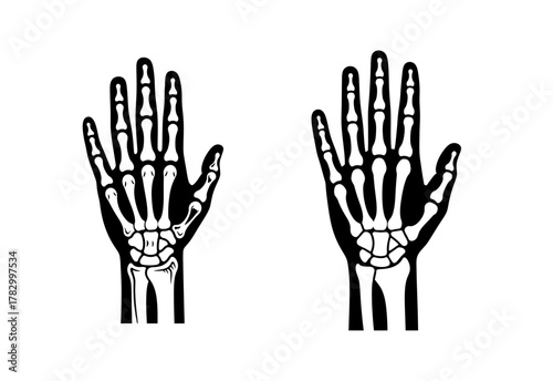 Two detailed black and white illustrations of human hand skeletons, showing bones of the wrist, palm, and fingers.