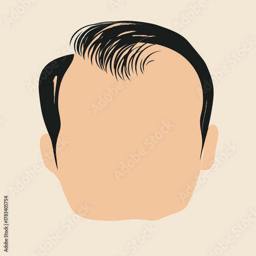 Minimalist vector illustration of male balding head with receding hairline and partial hair loss in flat style on beige background