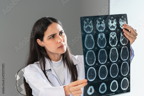 Female doctor examining a brain x-ray scan in a modern clinic office, focusing on medical diagnosis, healthcare analysis, and professional expertise in patient treatment and radiology practice.