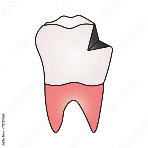 Broken Molar tooth 