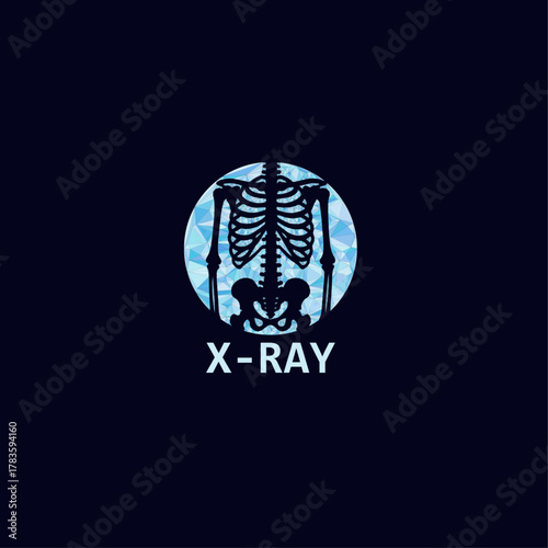 X Ray logo design
