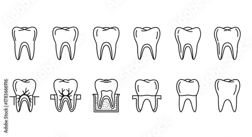 Set of outline dental icons representing different stages of tooth health and treatment, including healthy teeth, root canals, and crowns, ideal for dental clinics, educational materials, and