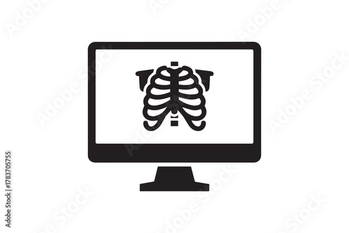 Digital x ray scan on computer monitor silhouette Radiography and healthcare technology concept design