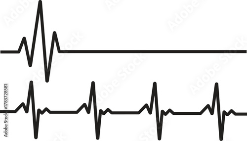 Heartbeat Pulse Line Vector - EKG ECG Electrocardiogram