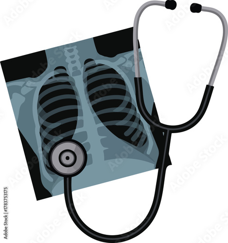 Medical Diagnosis Concept With Stethoscope And Lung Xray Vector