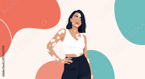 Understanding the beauty of skin diversity and embracing unique skin conditions with confidence.