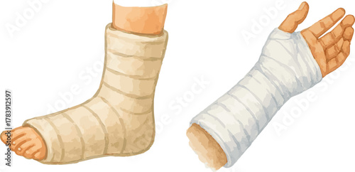 Watercolor vector painted hand and leg in cast