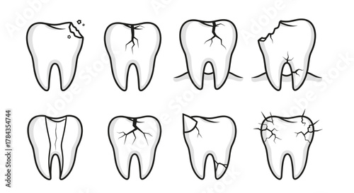 Collection of eight cartoon vector illustrations depicting various stages of tooth damage, including chips, cracks, and fractures, presented on a clean white background, ideal for dental health
