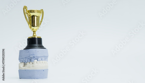 Dental Trophy Displayed on Plaster Cast Model
