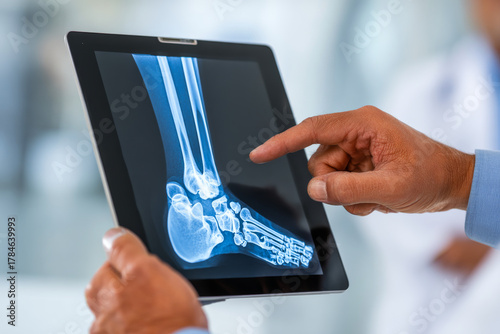 Patient views detailed X-ray of ankle on tablet during medical consultation in clinic