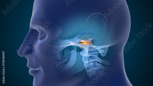 3D Medical Animation of TMJ Joint Disorder