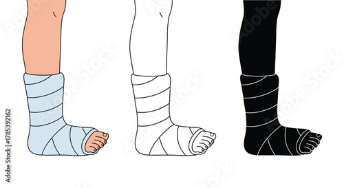 Foot cast illustration broken leg recovery medical bandage vector art