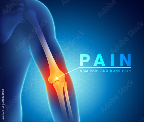 Conceptual 3D of an arm with a glowing, painful elbow joint, illustrating conditions like arthritis, injury, or inflammation. Medical pain and bone problem visualization. Vector illustration