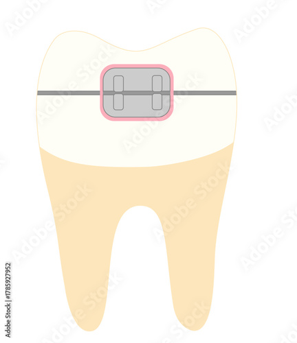 dental braces
