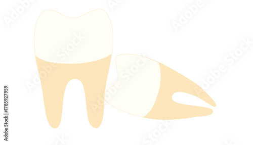 impacted tooth