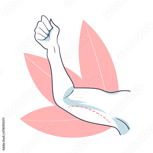 Plastic Surgery with Arm Body Part Correction in Aesthetic Beauty Clinic Vector Illustration