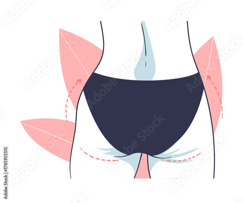 Plastic Surgery with Buttocks Body Part Correction in Aesthetic Beauty Clinic Vector Illustration
