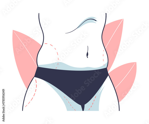 Plastic Surgery with Fat on Belly Correction in Aesthetic Beauty Clinic Vector Illustration