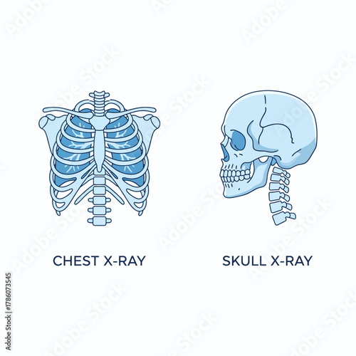 High-Quality Medical X-Ray Images for Healthcare Professionals and Education
