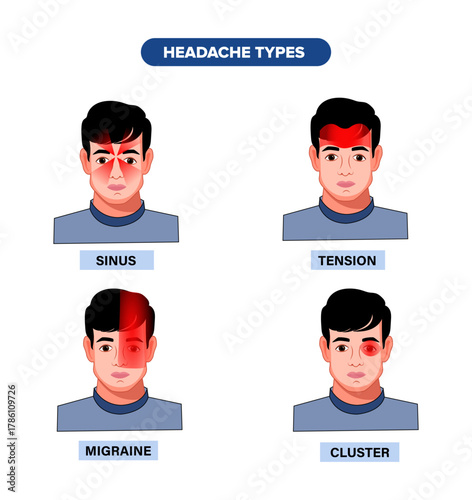 Tension, Cluster, and Migraine Headache Types Vector Illustration