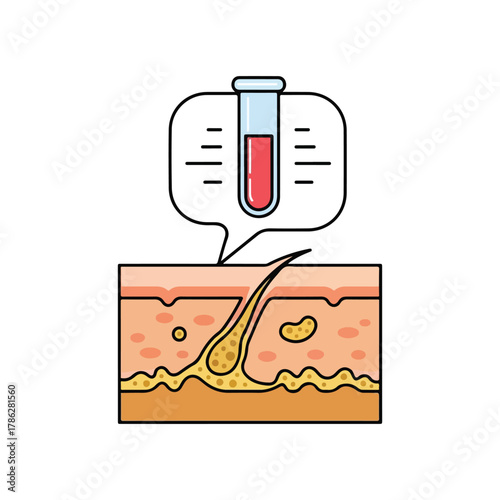Cross section of skin with hair follicle and test tube