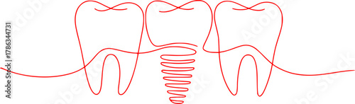Minimalist Red Line Art of Teeth and Dental Implant