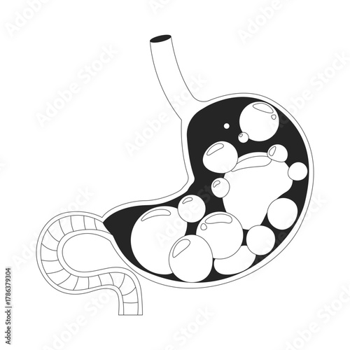 Gassy and bloated stomach with gas bubbles outline illustration. Digestive health. Indigestion symptom. Human organ cross-section 2D line object isolated on white. Monochrome vector ink linear image