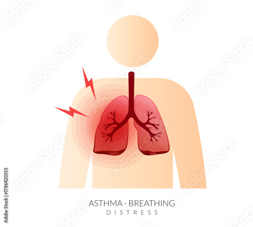 Asthma - Lungs with Breathing Distress - Stock Illustration