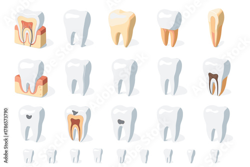 Tooth Disease and Decay Stages Set – Dental Caries and Oral Health Illustration