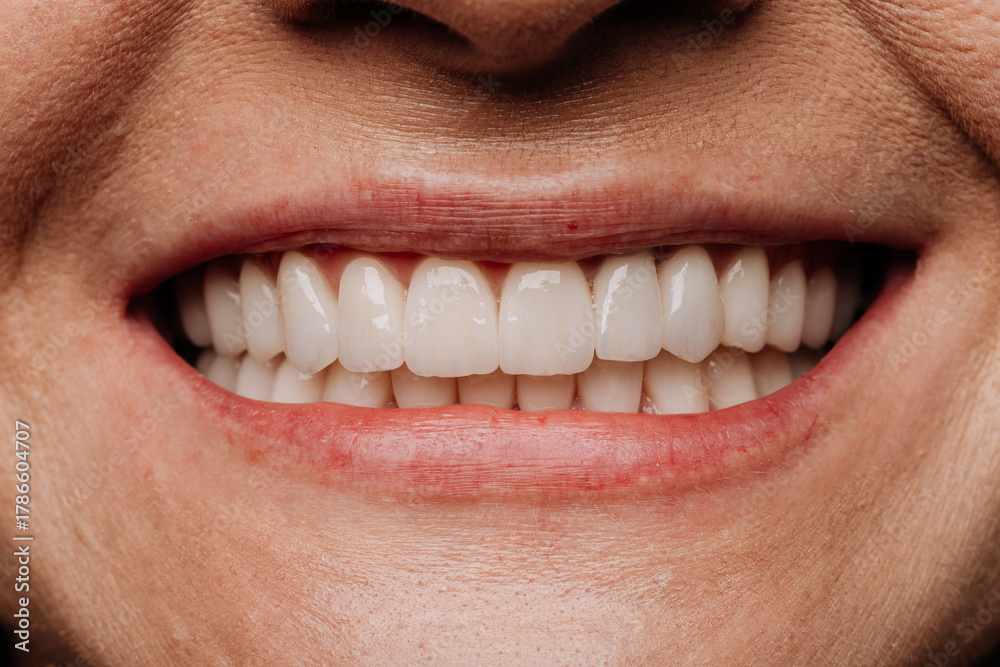 Obraz premium Closeup mature smile with natural white veneers and healthy teeth dental aesthetics