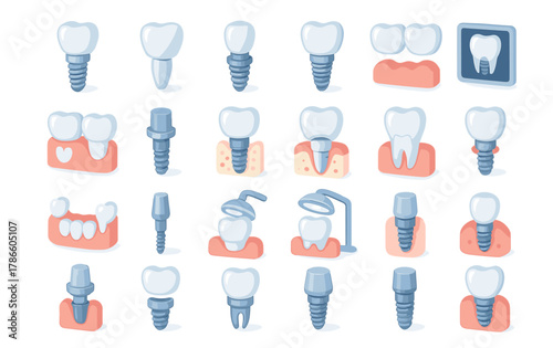 Dental Implant Procedure Vector Set — Tooth Implant Stages and Oral Surgery Illustration