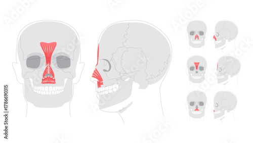 Set of Nasal muscles anatomy diagram, procerus, nasalis transverse part, nasalis alar part, depressor septi labeled, face muscles illustration, medical reference chart, education schematic