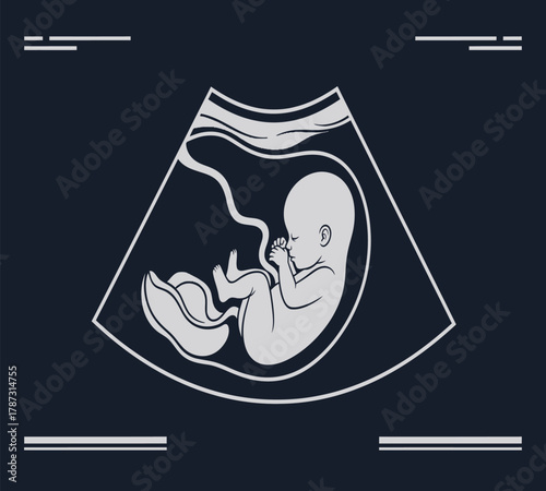 Illustration of ultrasound of a human fetus inside the mothers womb, showing the babys development and growth during pregnancy