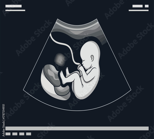 Illustration of ultrasound of a human fetus inside the mothers womb, showing the babys development and growth during pregnancy